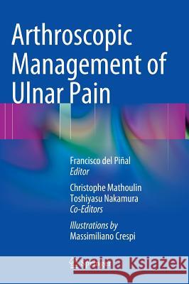 Arthroscopic Management of Ulnar Pain Francisco De 9783642305436 Springer, Berlin - książka