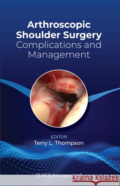 Arthroscopic Shoulder Surgery: Complications and Management Thompson, Terry 9781630917050 Slack - książka