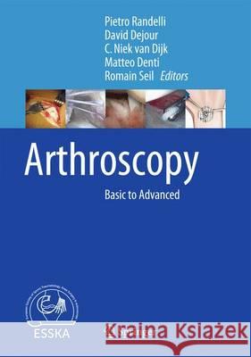 Arthroscopy: Basic to Advanced Randelli, Pietro 9783662493748 Springer - książka