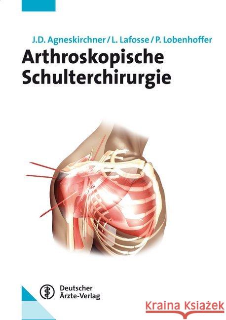Arthroskopische Schulterchirurgie Agneskirchner, Jens D.; Lafosse, Laurent; Lobenhoffer, Philipp 9783769105490 Deutscher Ärzte-Verlag - książka