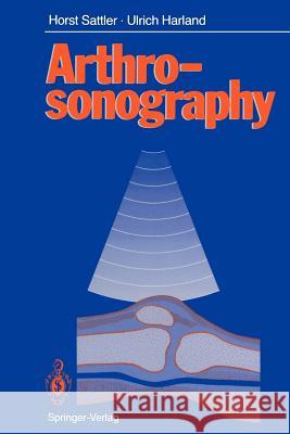 Arthrosonography Horst Sattler Ulrich Harland Terry C. Telger 9783642738692 Springer - książka