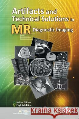 Artifacts and Technical Solutions in MR Diagnostic Imaging Luca Bartalini, Alan Gerevini 9781728734927 Independently Published - książka