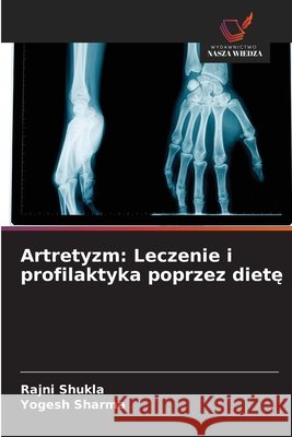 Artretyzm: Leczenie i profilaktyka poprzez diete Shukla, Rajni, Sharma, Yogesh 9786209781247 Wydawnictwo Nasza Wiedza - książka