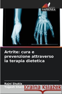 Artrite: cura e prevenzione attraverso la terapia dietetica Shukla, Rajni, Sharma, Yogesh 9786209778681 Edizioni Sapienza - książka