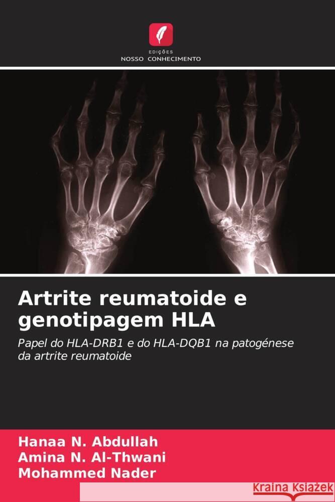 Artrite reumatoide e genotipagem HLA Hanaa N. Abdullah Amina N. Al-Thwani Mohammed Nader 9786208013929 Edicoes Nosso Conhecimento - książka