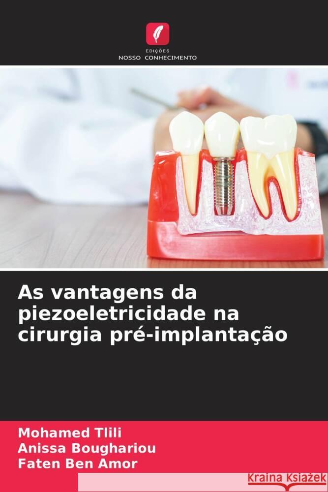 As vantagens da piezoeletricidade na cirurgia pr?-implanta??o Mohamed Tlili Anissa Boughariou Faten Be 9786207162628 Edicoes Nosso Conhecimento - książka