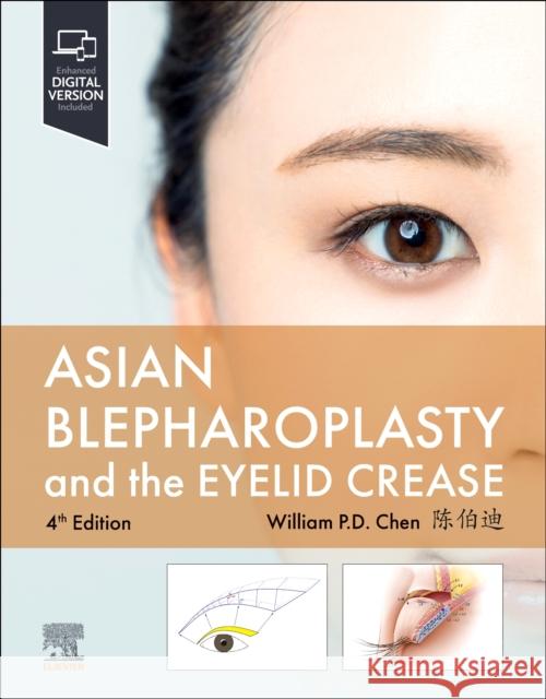 Asian Blepharoplasty and the Eyelid Crease William P. Chen 9780323878760 Elsevier - Health Sciences Division - książka