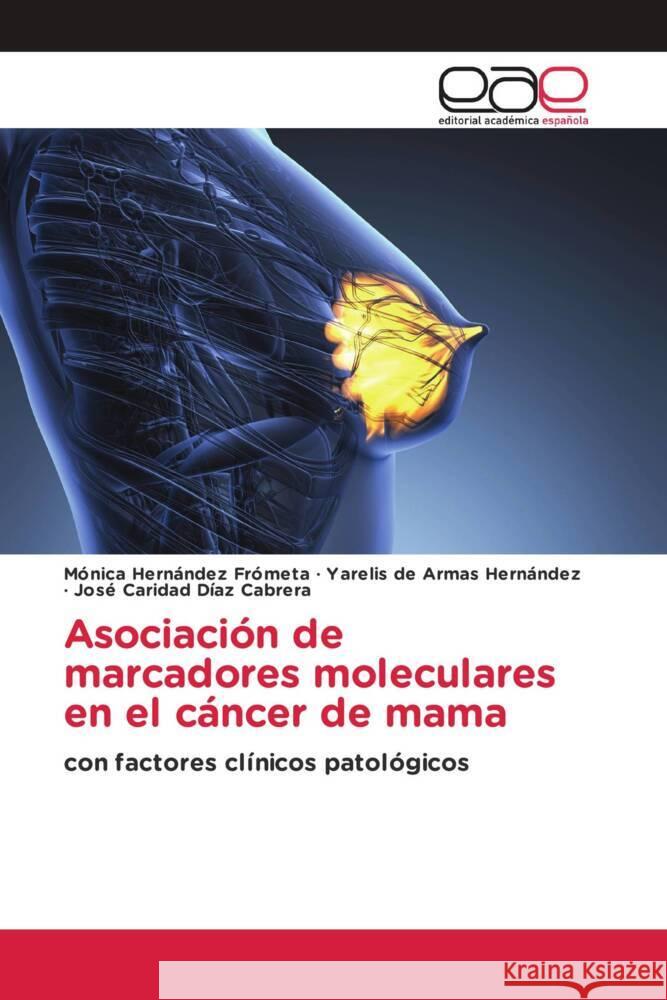 Asociación de marcadores moleculares en el cáncer de mama Hernández Frometa, Mónica, de Armas Hernández, Yarelis, Díaz Cabrera, José Caridad 9786203887242 Editorial Académica Española - książka