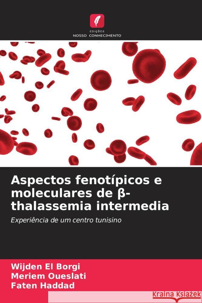 Aspectos fenot?picos e moleculares de β-thalassemia intermedia Wijden E Meriem Oueslati Faten Haddad 9786205321782 Edicoes Nosso Conhecimento - książka