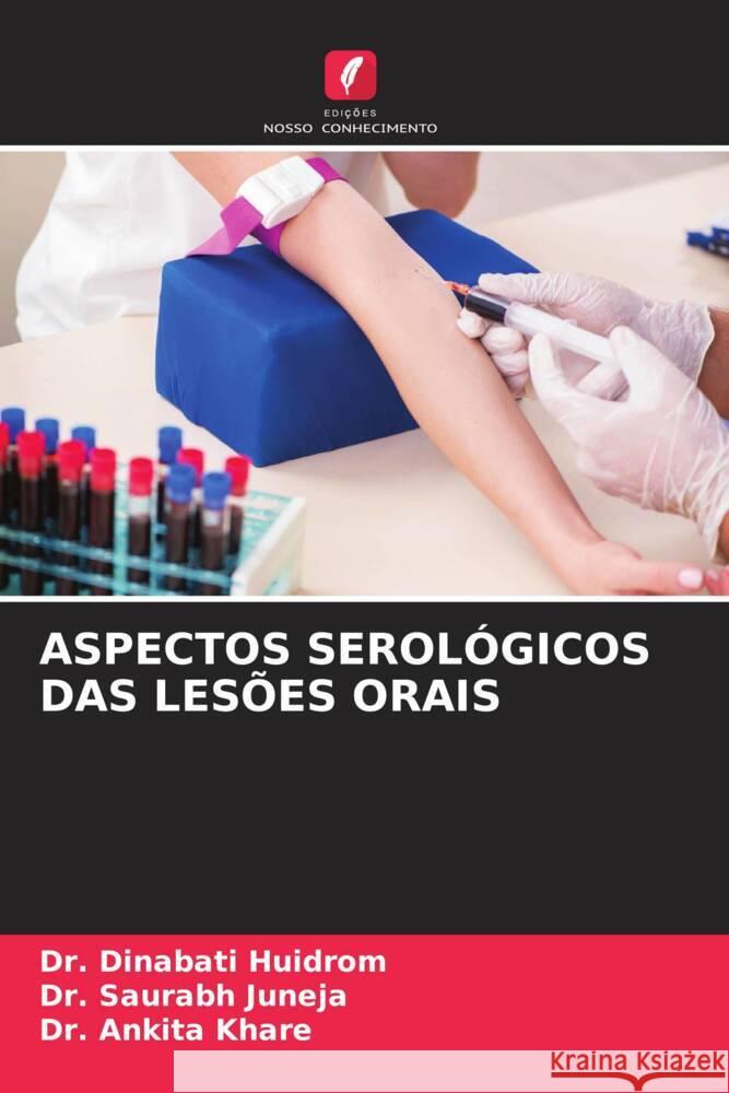 ASPECTOS SEROLÓGICOS DAS LESÕES ORAIS Huidrom, Dr. Dinabati, Juneja, Dr. Saurabh, Khare, Dr. Ankita 9786207100927 Edições Nosso Conhecimento - książka