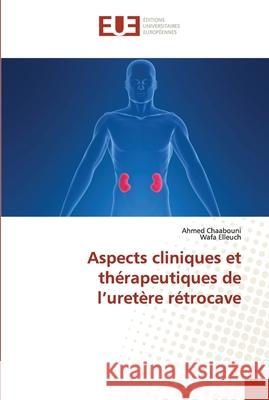 Aspects cliniques et thérapeutiques de l'uretère rétrocave Chaabouni, Ahmed 9786203425307 Editions Universitaires Europeennes - książka