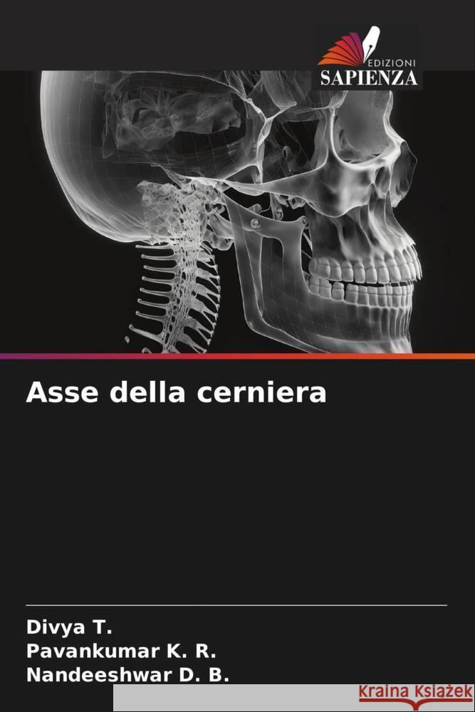 Asse della cerniera T., Divya, K. R., Pavankumar, D. B., Nandeeshwar 9786206456285 Edizioni Sapienza - książka