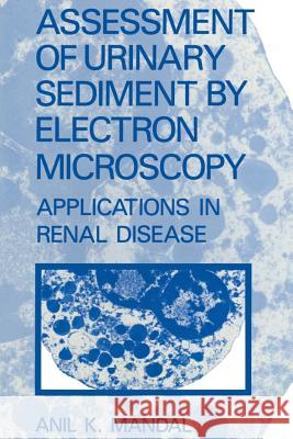 Assessment of Urinary Sediment by Electron Microscopy: Applications in Renal Disease Mandal, A. K. 9781461290339 Springer - książka