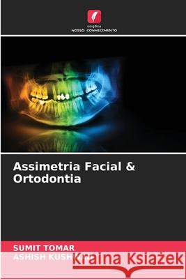 Assimetria Facial & Ortodontia Sumit Tomar, Ashish Kushwah 9786204158471 Edicoes Nosso Conhecimento - książka
