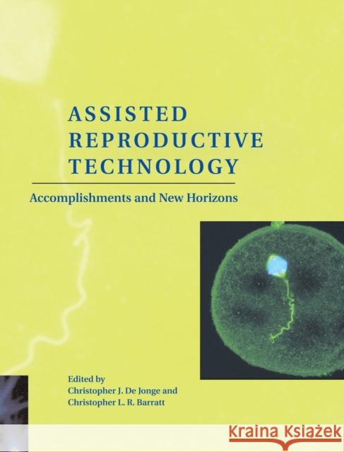 Assisted Reproductive Technology: Accomplishments and New Horizons de Jonge, Christopher J. 9780521801218 Cambridge University Press - książka