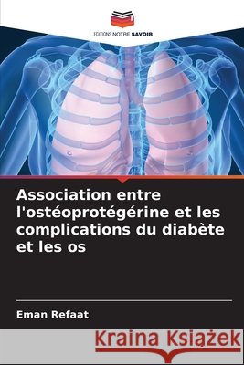 Association entre l'ostéoprotégérine et les complications du diabète et les os Refaat, Eman 9786209490347 Editions Notre Savoir - książka