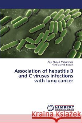 Association of hepatitis B and C viruses infections with lung cancer Mohammed, Adel Ahmed 9783659380891 LAP Lambert Academic Publishing - książka