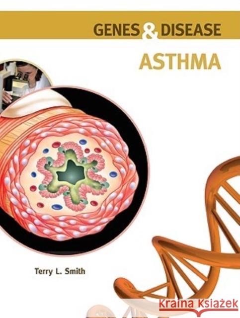 Asthma Terry L Smith 9780791096635 Chelsea House Publishers - książka