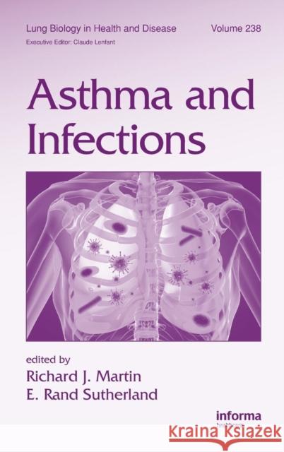 Asthma and Infections Richard Martin E. Rand Sutherland 9781420092998 Informa Healthcare - książka