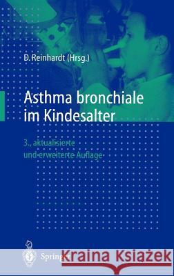 Asthma Bronchiale Im Kindesalter Dietrich Reinhardt 9783540652403 Springer - książka