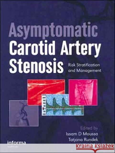 Asymptomatic Carotid Artery Stenosis: A Primer on Risk Stratification and Management Moussa, Issam D. 9781841846132 Informa Healthcare - książka