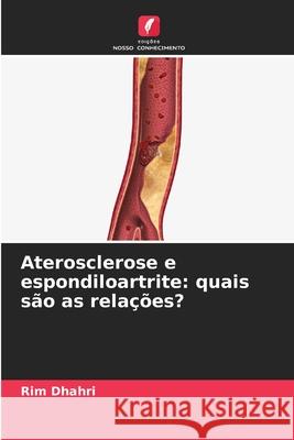 Aterosclerose e espondiloartrite: quais são as relações? Dhahri, Rim 9786209283949 Edições Nosso Conhecimento - książka