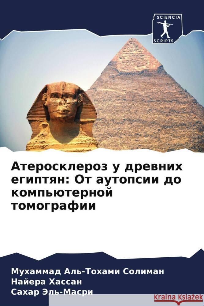 Ateroskleroz u drewnih egiptqn: Ot autopsii do komp'üternoj tomografii Al'-Tohami Soliman, Muhammad, Hassan, Najera, Jel'-Masri, Sahar 9786208202583 Sciencia Scripts - książka