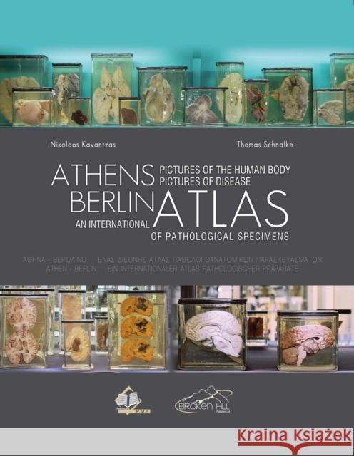 Athens Berlin: An International Atlas of Pathological Specimens: Pictures of the Human Body Pictures of Disease Nikolaos Kavantzas Thomas Schnalke 9789925575701 Paschalidis Medical Publications - książka