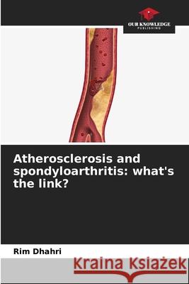 Atherosclerosis and spondyloarthritis: what's the link? Dhahri, Rim 9786209276262 Our Knowledge Publishing - książka