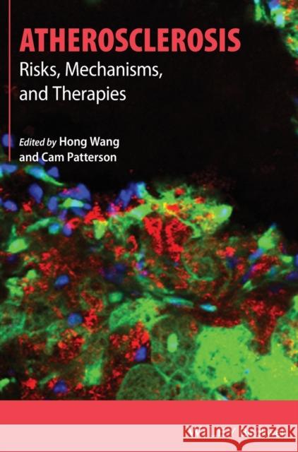 Atherosclerosis: Risks, Mechanisms, and Therapies Wang, Hong 9781118285916 John Wiley & Sons - książka