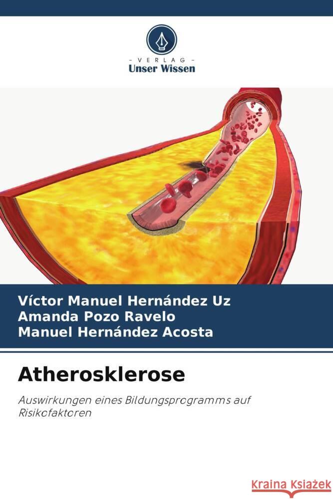 Atherosklerose V?ctor Manuel Hern?nde Amanda Poz Manuel Hern?nde 9786207302505 Verlag Unser Wissen - książka