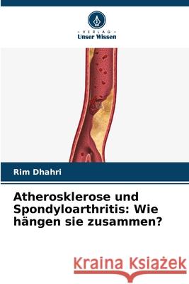 Atherosklerose und Spondyloarthritis: Wie hängen sie zusammen? Dhahri, Rim 9786209278822 Verlag Unser Wissen - książka