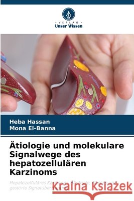 Ätiologie und molekulare Signalwege des hepatozellulären Karzinoms Hassan, Heba, El-Banna, Mona 9786630251395 Verlag Unser Wissen - książka