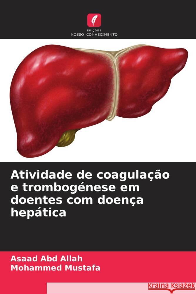 Atividade de coagulação e trombogénese em doentes com doença hepática Abd Allah, Asaad, Mustafa, Mohammed 9786208183189 Edições Nosso Conhecimento - książka