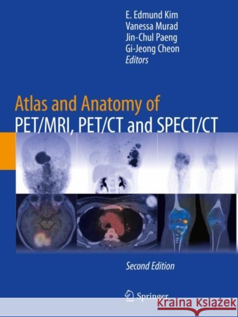 Atlas and Anatomy of PET/MRI, PET/CT and SPECT/CT E. Edmund Kim Vanessa Murad Jin-Chul Paeng 9783030923518 Springer - książka