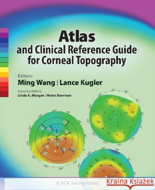 Atlas and Clinical Reference Guide for Corneal Topography Ming Wang Lance J. Kugler 9781617110276 Slack - książka