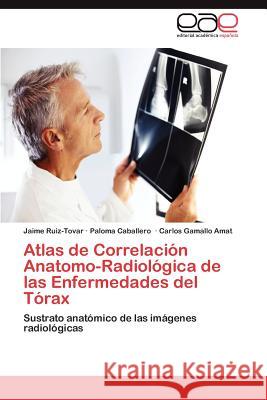 Atlas de Correlación Anatomo-Radiológica de las Enfermedades del Tórax Ruiz-Tovar Jaime 9783847357193 Editorial Acad Mica Espa Ola - książka