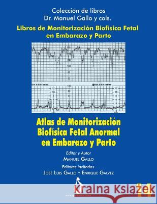 Atlas de Monitorizacion Biofisica Fetal Anormal En El Embarazo Y Parto Jose Padilla Manuel Gallo 9781790849673 Independently Published - książka