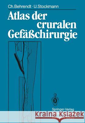 Atlas Der Cruralen Gefäßchirurgie Behrendt, Christina 9783540138204 Springer - książka