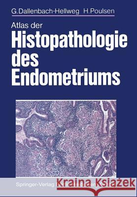 Atlas Der Histopathologie Des Endometriums G. Dallenbach-Hellweg H. Poulsen 9783662058763 Springer - książka