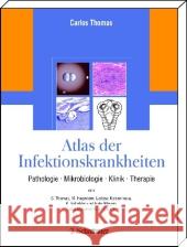 Atlas der Infektionskrankheiten : Pathologie, Mikrobiologie, Klinik, Therapie Thomas, Carlos   9783794527625 Schattauer - książka