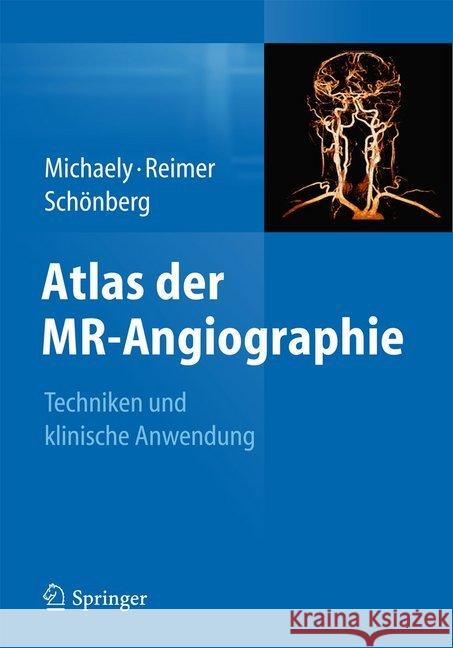 Atlas Der Mr-Angiographie: Techniken Und Klinische Anwendung Michaely, Henrik J. 9783642105272 Springer - książka