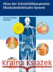 Atlas der Schnittbildanatomie: Muskuloskelettales System Möller, Torsten B. Reif, Emil  9783131417718 Thieme, Stuttgart - książka