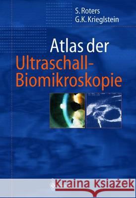 Atlas Der Ultraschall-Biomikroskopie Roters, Sigrid 9783642631443 Springer - książka