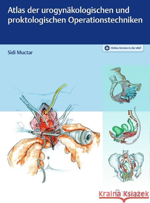 Atlas der urogynäkologischen und proktokologischen Operationstechniken : Mit Online-Zugang Muctar, Sidi 9783132416796 Thieme, Stuttgart - książka