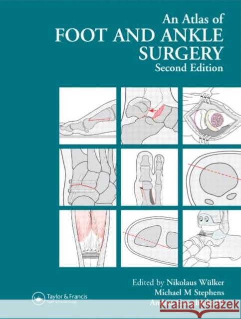 Atlas Foot and Ankle Surgery Nikolaus Wulker Michael Stephens Andrea C. Cracciolo 9781841841953 Taylor & Francis Group - książka