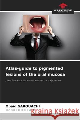 Atlas-guide to pigmented lesions of the oral mucosa Obaid Garouachi Hend Ouertani 9786209301407 Our Knowledge Publishing - książka