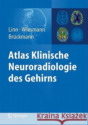 Atlas Klinische Neuroradiologie des Gehirns Jennifer Linn Martin Wiesmann Hartmut Bra1/4ckmann 9783540895688 Springer - książka