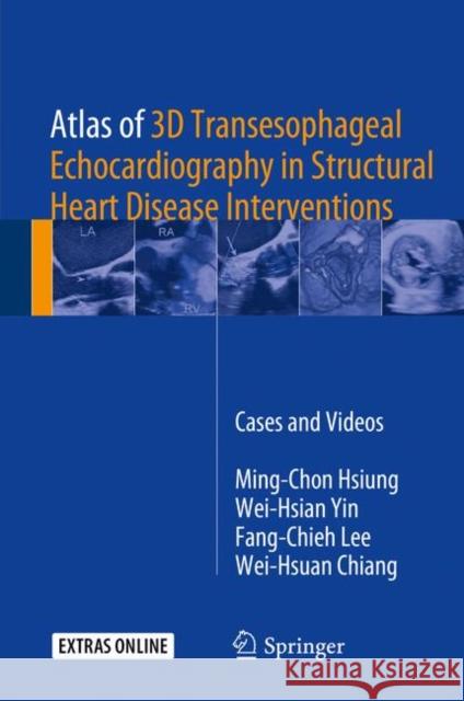Atlas of 3D Transesophageal Echocardiography in Structural Heart Disease Interventions: Cases and Videos Hsiung, Ming-Chon 9789811069369 Springer - książka
