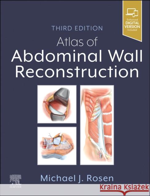 Atlas of Abdominal Wall Reconstruction Michael J. Rosen 9780443118500 Elsevier - książka